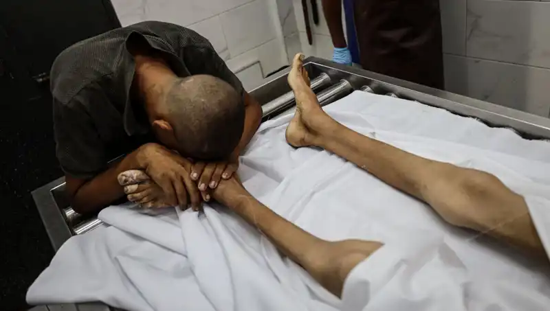 Gazze'de Açlık Faciası: Bir Çocuk Daha Hayatını Kaybetti