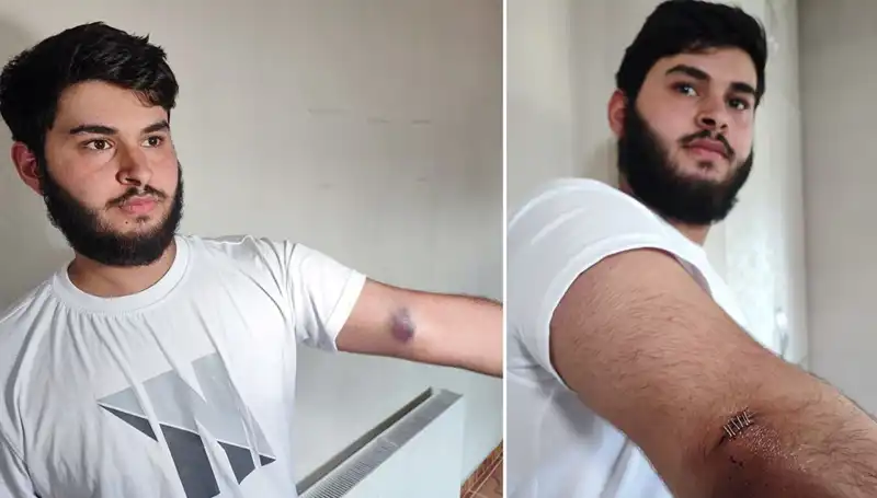 Bahçeye Kaçan Top, Mahallede Büyük Heyecan Yarattı