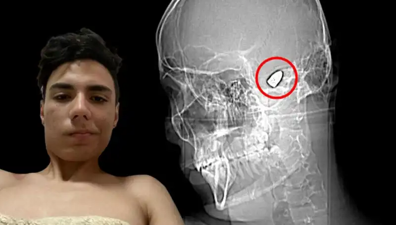 Kafasında Patlayıcı Var Gibi Yaşayanlar: Hayat Mücadelesi ve Psikolojik Etkiler