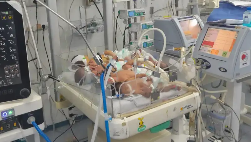 Gazzeli Doktorların Çaresizliği: Aynı Kuvözde Birden Fazla Bebek Hayata Tutunmaya Çalışıyor